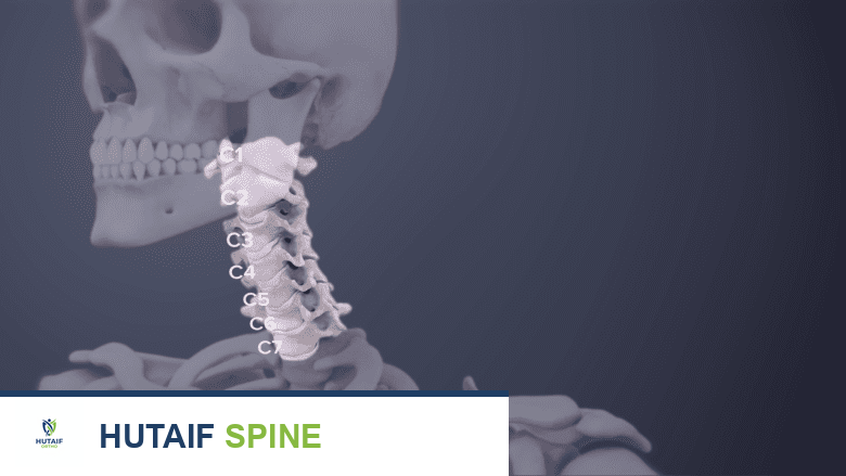 استبدال القرص الصناعي مقابل دمج الفقرات العنقية الأمامي: دليل شامل لخيارات علاج الرقبة في اليمن