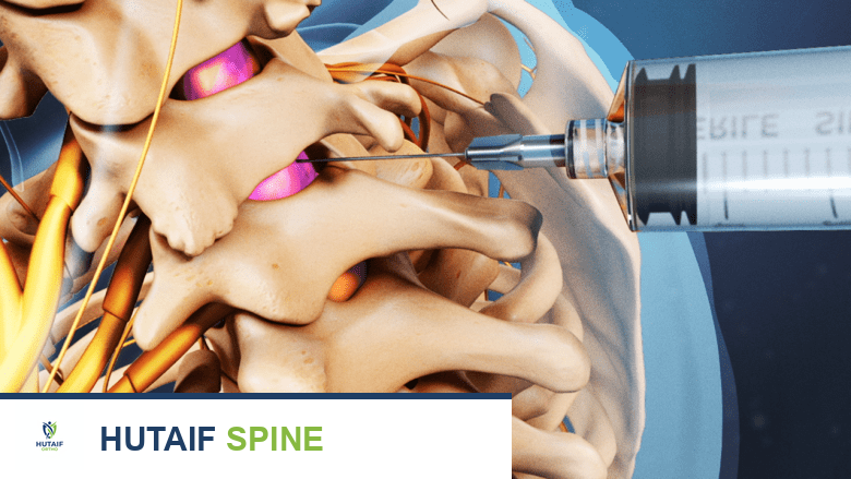 دليلك الشامل لعلاج آلام ومشاكل فقرات الرقبة C2-C5 مع الأستاذ الدكتور محمد هطيف