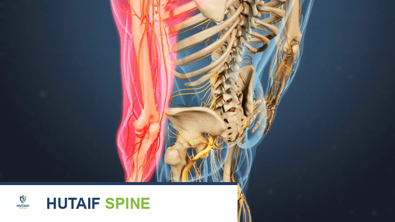 An illiustration showing upper limb highlighted in red.