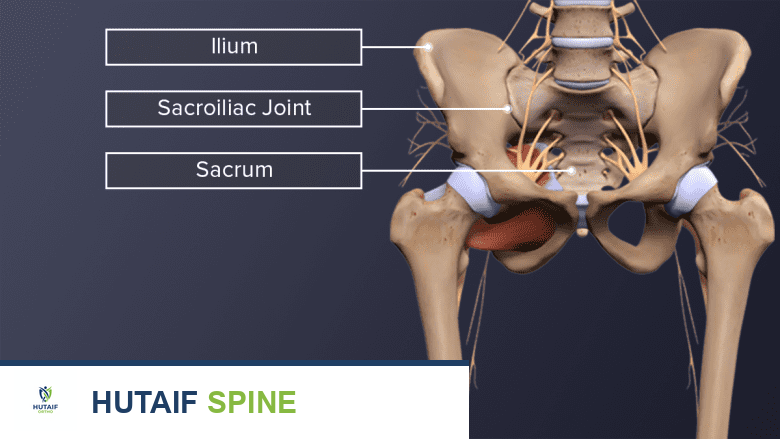 صورة توضيحية للانزلاق الغضروفي (الديسك)
