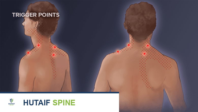 نتوءات العظم في الرقبة: دليل شامل للعلاج والوقاية مع الأستاذ الدكتور محمد هطيف
