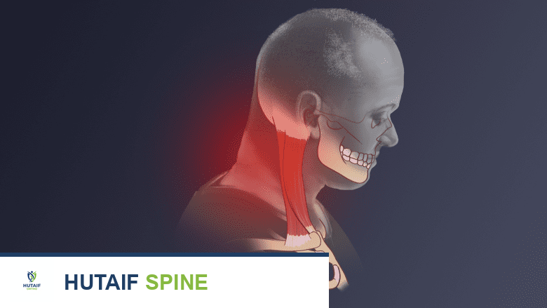الصداع العنقي: الأسباب، الأعراض، التشخيص والعلاج الشامل مع الأستاذ الدكتور محمد هطيف في صنعاء