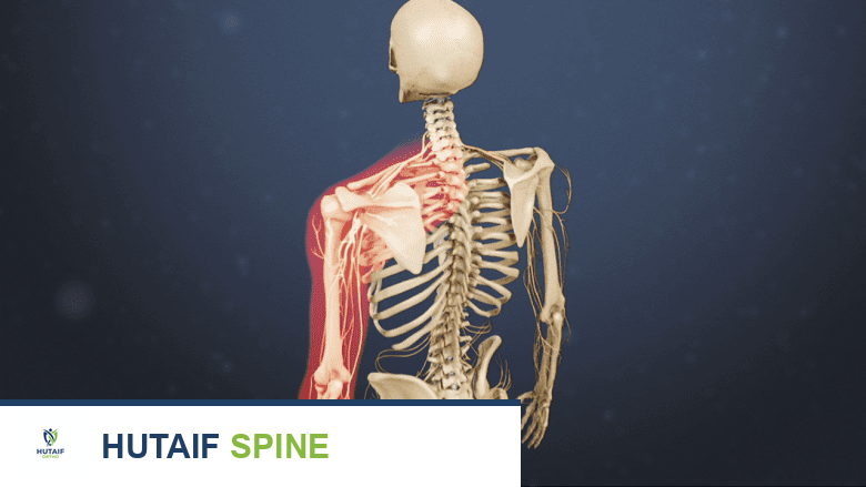 النتوءات العظمية (المناقير العظمية): دليل شامل للأعراض، الأسباب، والخيارات العلاجية مع الأستاذ الدكتور محمد هطيف