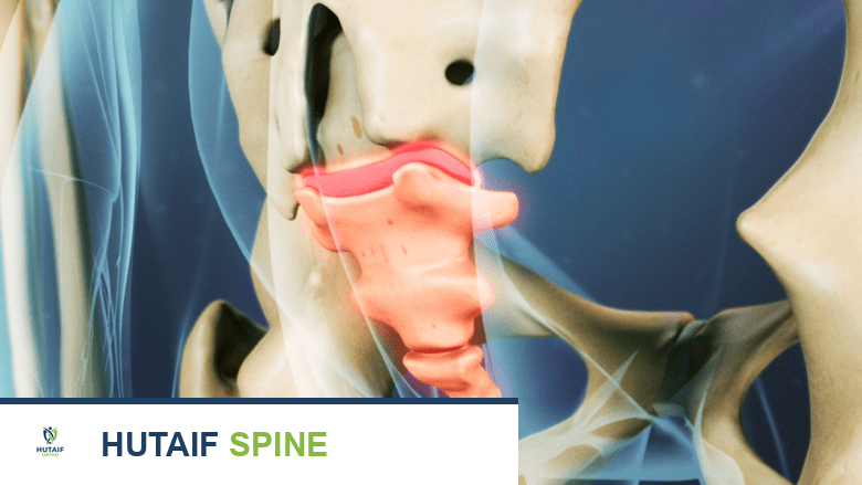 ألم العصعص الأسباب الشاملة وعوامل الخطر وطرق التشخيص والعلاج مع الأستاذ الدكتور محمد هطيف