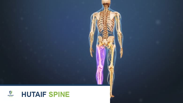 صورة توضيحية لهيكل عظمي مع تسليط الضوء على إحدى الساقين باللون الوردي.