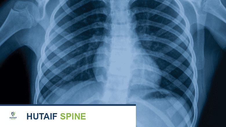 تشخيص التهاب مفاصل العمود الفقري: دليل شامل من الأستاذ الدكتور محمد هطيف