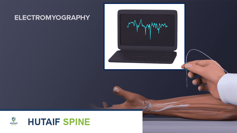 تخطيط العضلات والأعصاب (EMG و NCS): دليلك الشامل مع الأستاذ الدكتور محمد هطيف