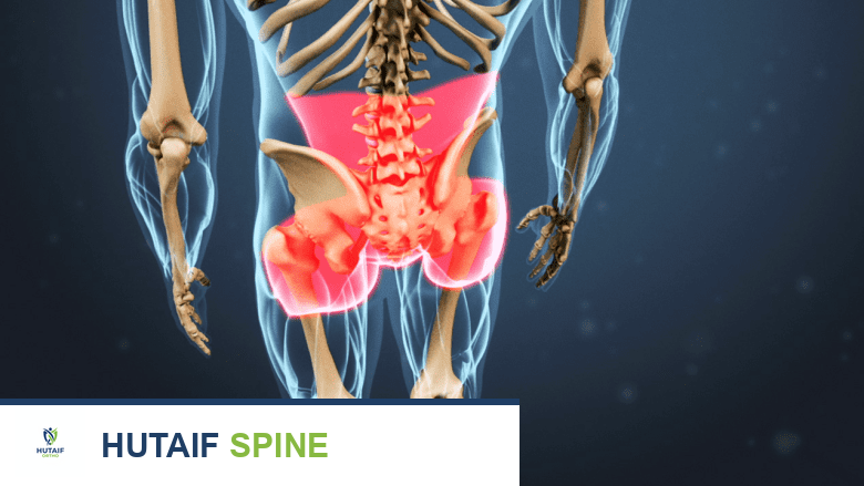 متلازمة فشل جراحة الظهر (FBSS) الأعراض الأسباب وكيفية تجنب الألم بعد الجراحة مع الأستاذ الدكتور محمد هطيف
