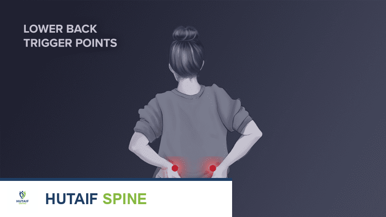 توضيح طبي: متلازمة فشل جراحة الظهر (FBSS) الأعراض الأسباب وكيفية تجنب الألم بعد الجراحة مع الأستاذ الدكتور محمد هطيف