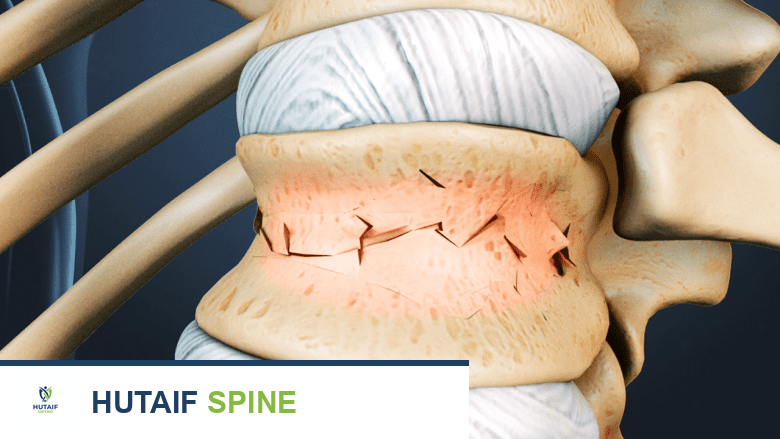 تقنية غراستون: دليل شامل لدواعي الاستخدام وموانعها وفوائدها مع الأستاذ الدكتور محمد هطيف في صنعاء