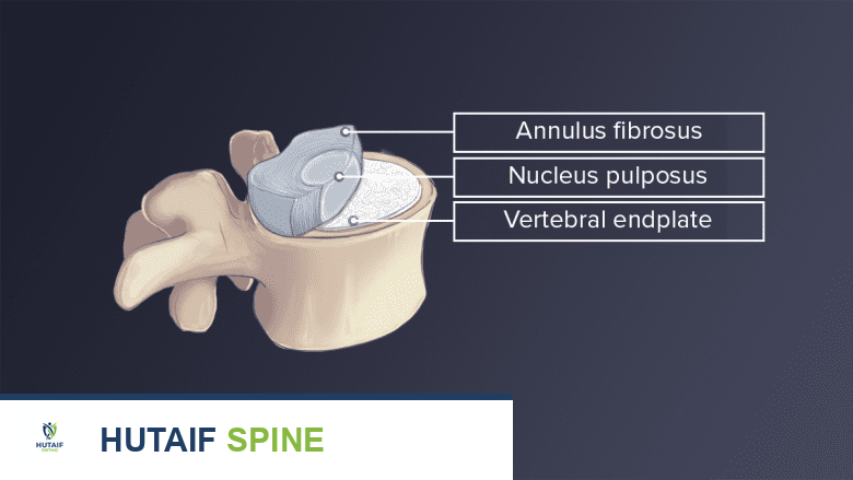 رسم توضيحي لتشريح الفقرات القطنية مع النواة اللبية والحلقة الليفية والصفائح الغضروفية