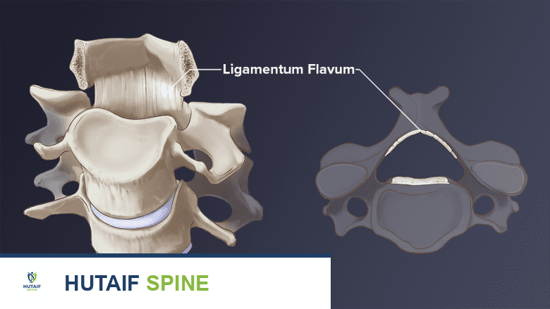 توضيح للرباط الأصفر