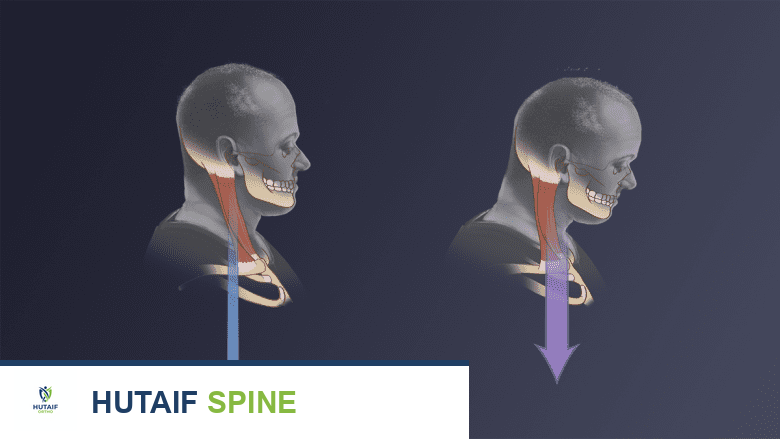 آلام الرقبة والوضعية الخاطئة: دليل شامل من الأستاذ الدكتور محمد هطيف في صنعاء
