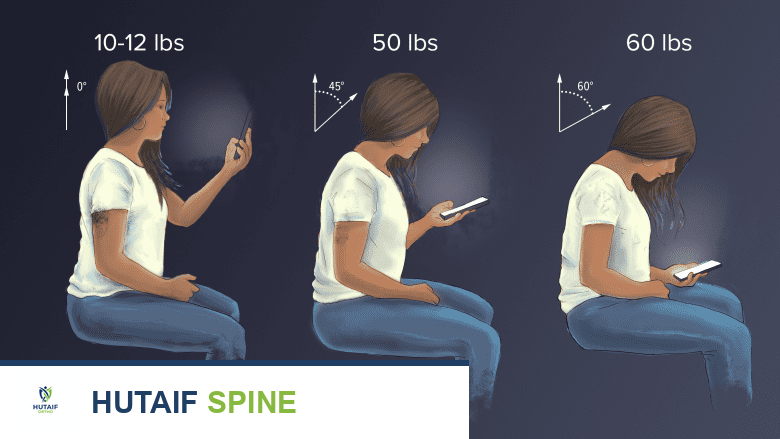 الرأس الأمامي المنحني: الأسباب، التشخيص، والعلاج الشامل مع الأستاذ الدكتور محمد هطيف في صنعاء