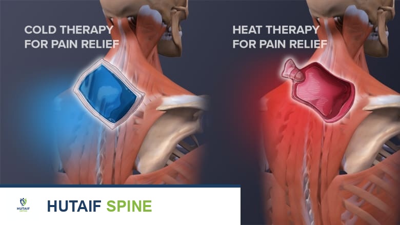 صورة توضيحية للعلاج بالثلج والحرارة