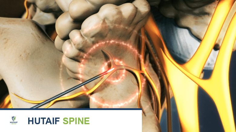 صورة توضيحية لـ علاج فقرات L4-L5: دليل شامل لآلام أسفل الظهر وعرق النسا مع الأستاذ الدكتور محمد هطيف