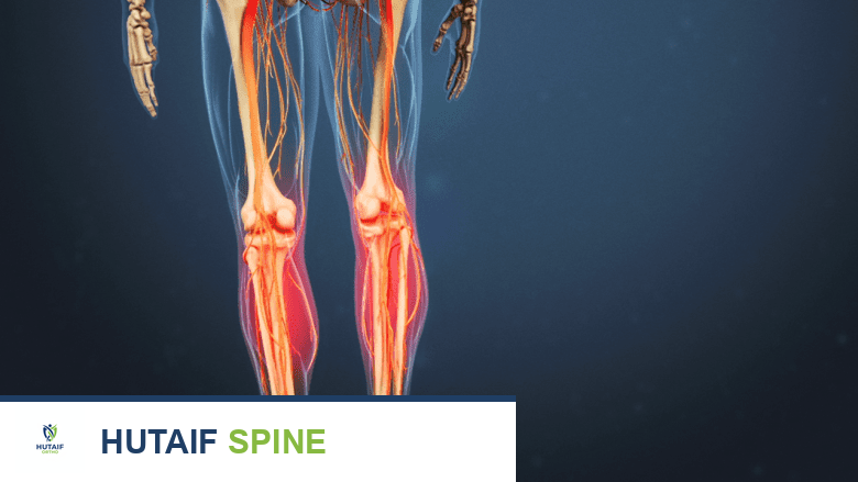 ألم الساق ومشاكل الأوعية الدموية: دليل شامل من الأستاذ الدكتور محمد هطيف في صنعاء