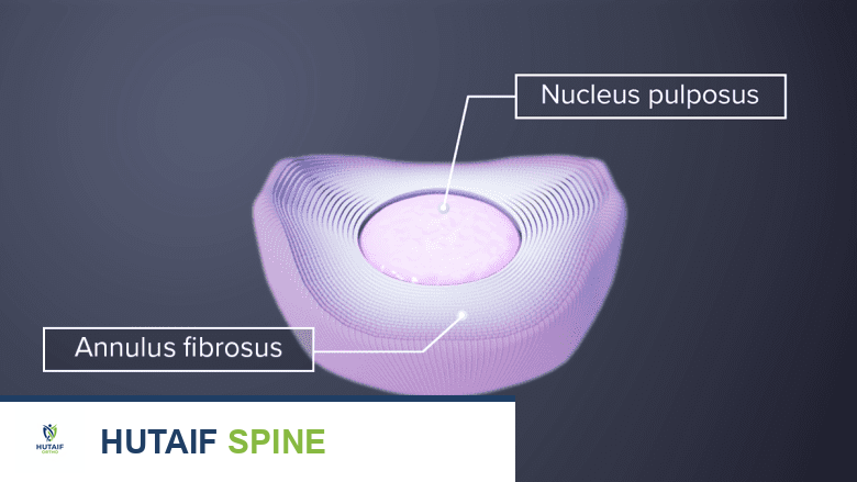 منظر علوي للنواة اللبية والحلقة الليفية للقرص الفقري