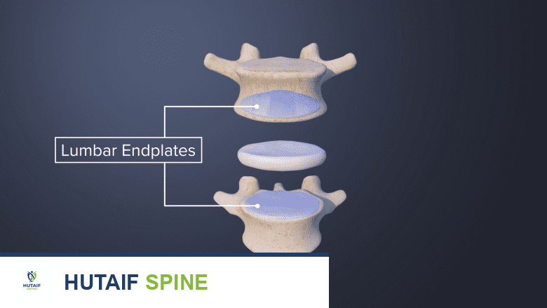 الصفائح النهائية بين فقرتين
