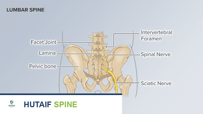 تضيق القناة الشوكية القطنية: دليل شامل لخيارات العلاج الجراحي وغير الجراحي
