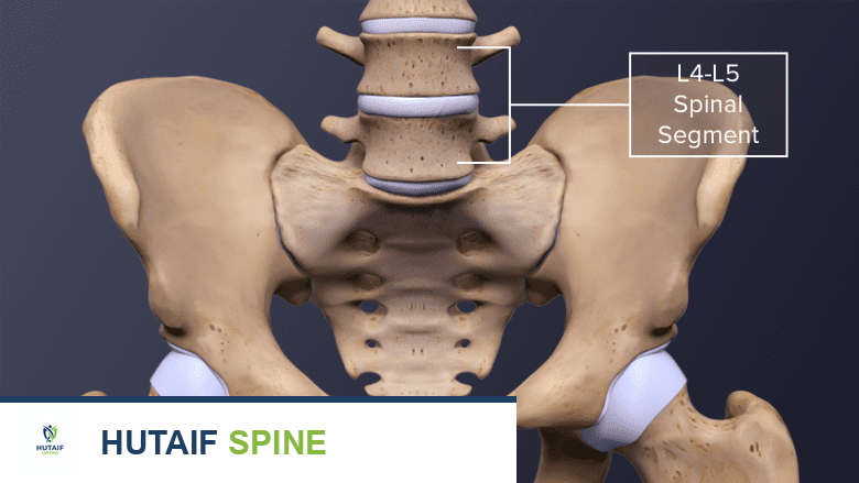 تصوير ثلاثي الأبعاد لعظم الورك والعمود الفقري القطني.