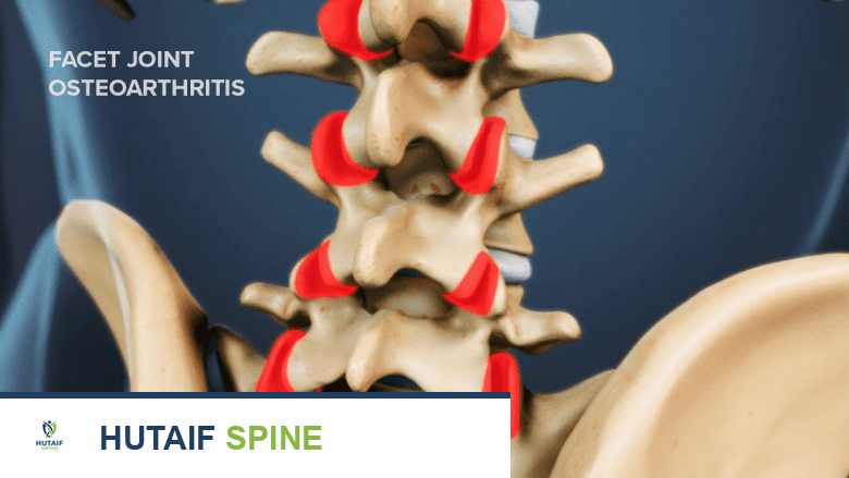 مراتب وأوضاع النوم المثالية لكل تشخيص لآلام الظهر: دليل شامل من الأستاذ الدكتور محمد هطيف