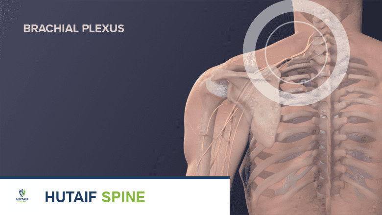 علاج آلام الظهر العلوي والكتف: دليل شامل من الأستاذ الدكتور محمد هطيف