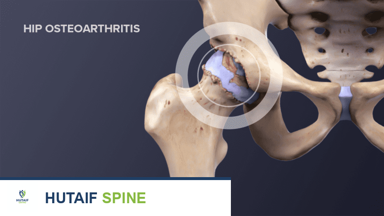 ألم الساق ومشاكل الجهاز العضلي الهيكلي: دليل شامل للتشخيص والعلاج مع الأستاذ الدكتور محمد هطيف