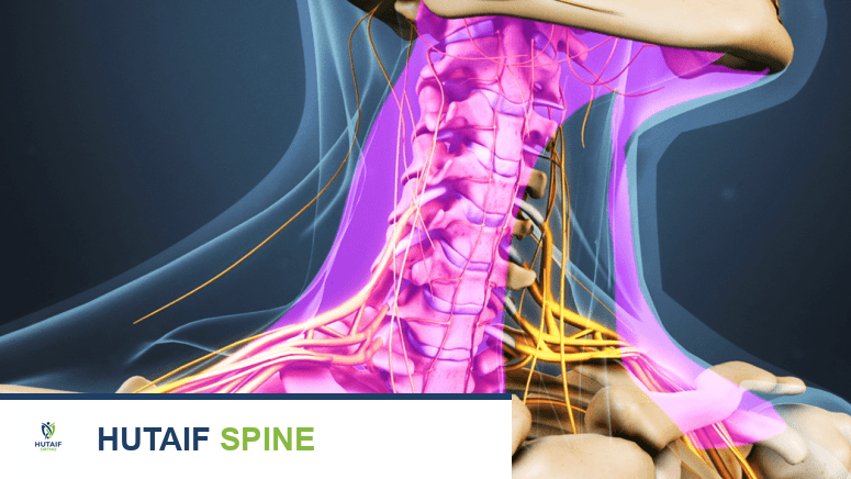 ألم الرقبة: دليلك الشامل للتشخيص والعلاج والوقاية مع الأستاذ الدكتور محمد هطيف