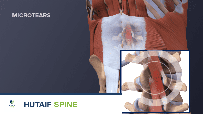 العلاج بالتدليك العصبي العضلي: حل شامل لآلام العضلات المزمنة والنقاط المحفزة مع الأستاذ الدكتور محمد هطيف في صنعاء