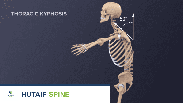 تشخيص هشاشة العظام: دليل شامل للوقاية والعلاج مع الأستاذ الدكتور محمد هطيف