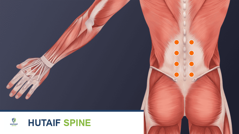 إبر العلاج بالتحفيز العصبي عبر الجلد مرتبة في أزواج على جانبي العمود الفقري وتمتد من منتصف الظهر إلى الأرداف. يحدد الطبيب عدد الإبر.