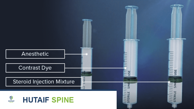 صورة توضيحية لعملية تشخيص متلازمة الكمثري في صنعاء