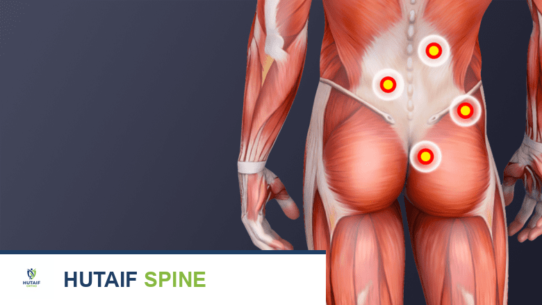 جراحة متلازمة الكمثري في صنعاء: دليل شامل مع الأستاذ الدكتور محمد هطيف