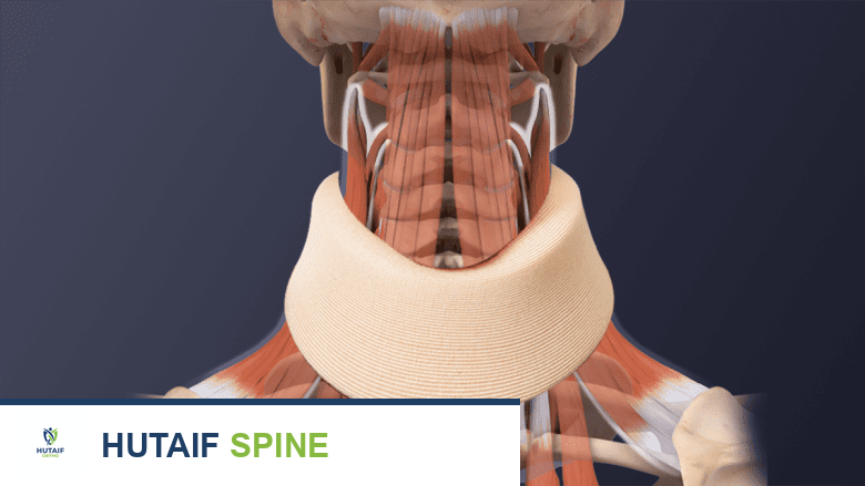 مخاطر ومضاعفات جراحة دمج الفقرات العنقية الأمامي (ACDF) والرعاية بعد الجراحة: دليل شامل للمرضى