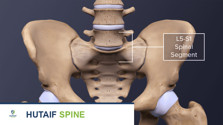 الوقاية من آلام أسفل الظهر في الجولف: دليل شامل من الأستاذ الدكتور محمد هطيف