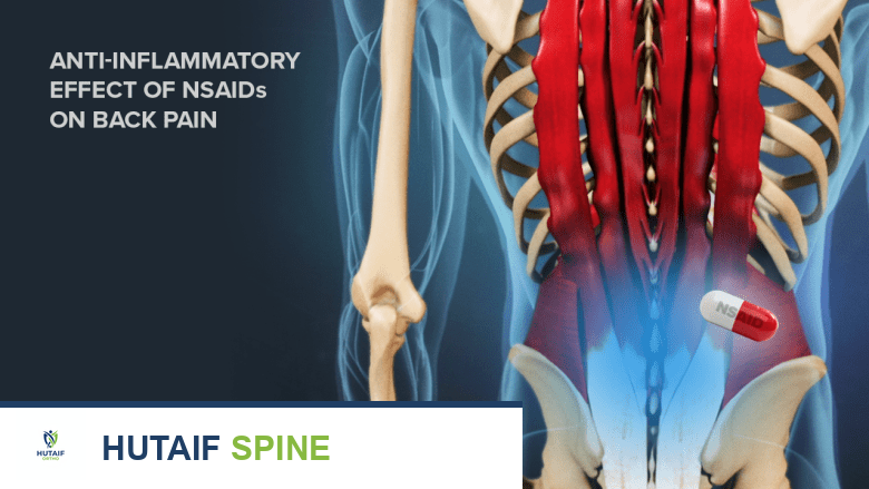 التعافي الشامل بعد جراحة دمج الفقرات المتعددة: دليل الأستاذ الدكتور محمد هطيف