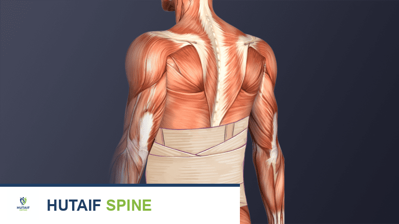 التعافي الشامل بعد جراحة دمج الفقرات المتعددة: دليل الأستاذ الدكتور محمد هطيف