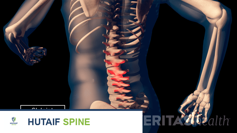 تشريح المفصل العجزي الحرقفي: دليلك الشامل من الأستاذ الدكتور محمد هطيف