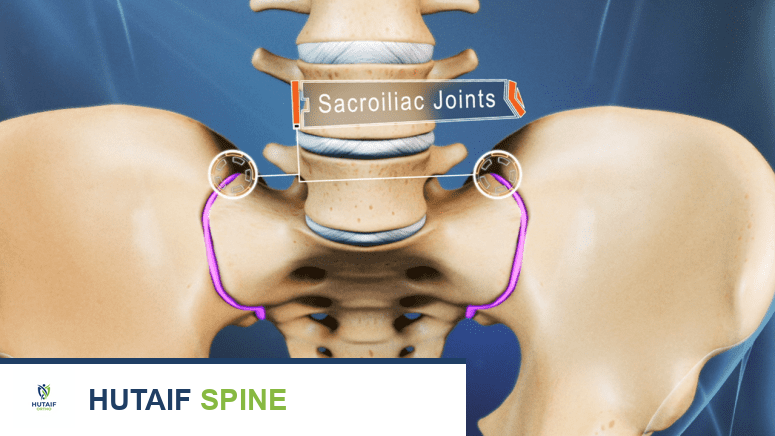 خلل المفصل العجزي الحرقفي: دليل شامل للأسباب، الأعراض، والحلول العلاجية المبتكرة في صنعاء