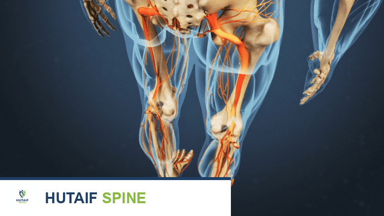 التعافي من جراحة الجنف: دليل شامل من 3 أشهر وما بعدها