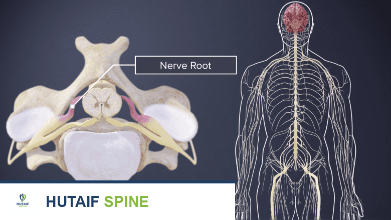 الحبل الشوكي وجذور الأعصاب الشوكية: دليل شامل لصحة عمودك الفقري مع الأستاذ الدكتور محمد هطيف