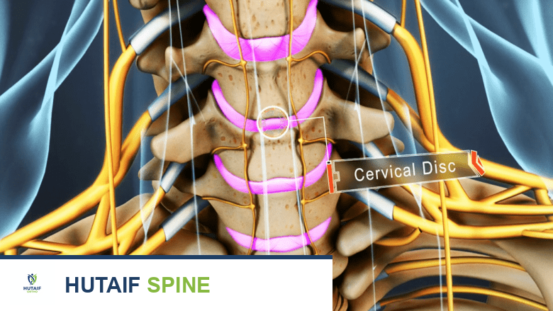 الأقراص الفقرية: دليلك الشامل لصحة عمودك الفقري مع الأستاذ الدكتور محمد هطيف