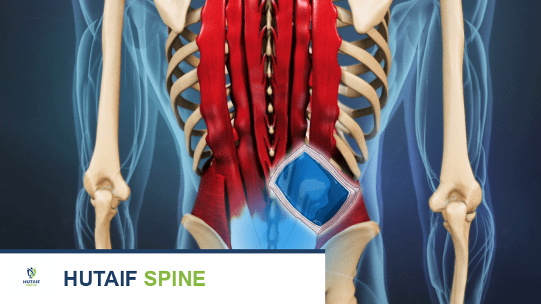 توضيح يظهر العلاج بالثلج لأسفل الظهر