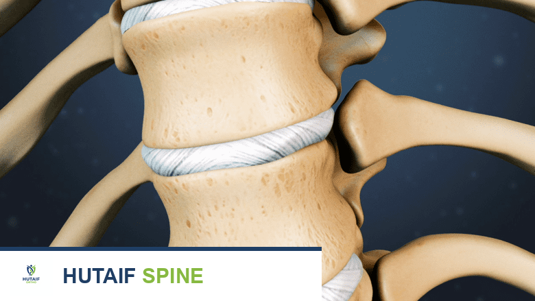 أقراص الظهر الصدرية: دليل شامل لفهم الألم والعلاج مع الأستاذ الدكتور محمد هطيف