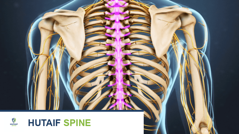 جراحة الانزلاق الغضروفي الصدري: دليل شامل للمرضى مع الأستاذ الدكتور محمد هطيف