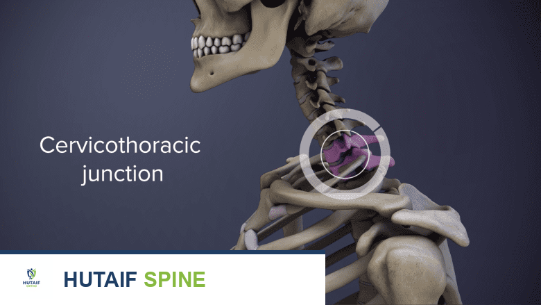 الفقرات الصدرية والقفص الصدري: دليل شامل لآلام الظهر العلوية والعلاج في صنعاء