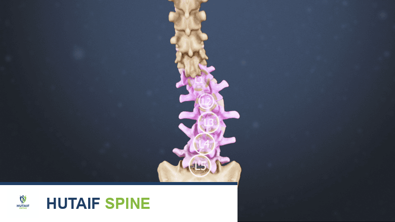 الجنف: دليل شامل لأنواعه، أسبابه، تشخيصه وعلاجه مع الأستاذ الدكتور محمد هطيف