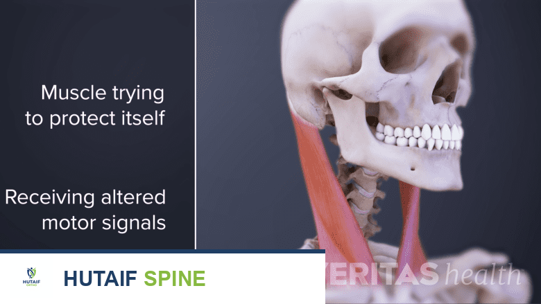 آلام الرقبة والكتف: دليل شامل للفهم والعلاج مع الأستاذ الدكتور محمد هطيف