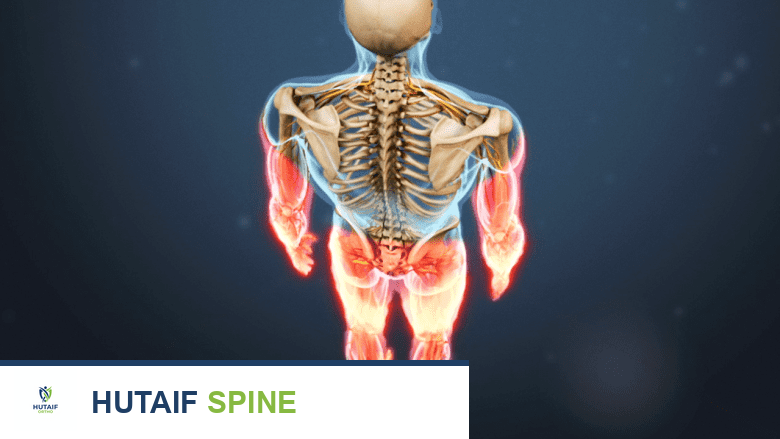 فهم أعراض الاعتلال العصبي: دليلك الشامل للتشخيص والعلاج مع الأستاذ الدكتور محمد هطيف في صنعاء